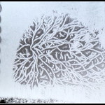 The curtains parted...