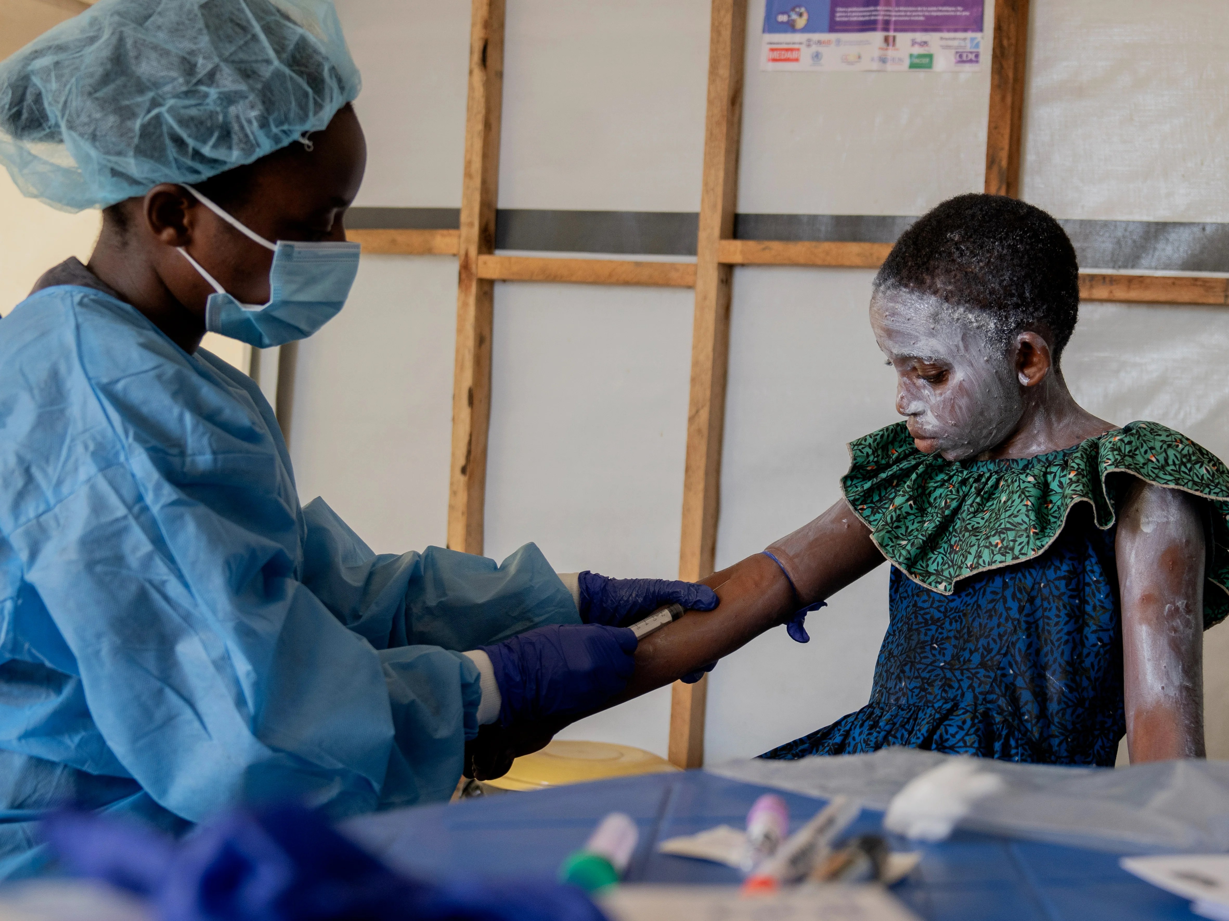 Diseases expert warns new deadly mpox strain may already be present in UK