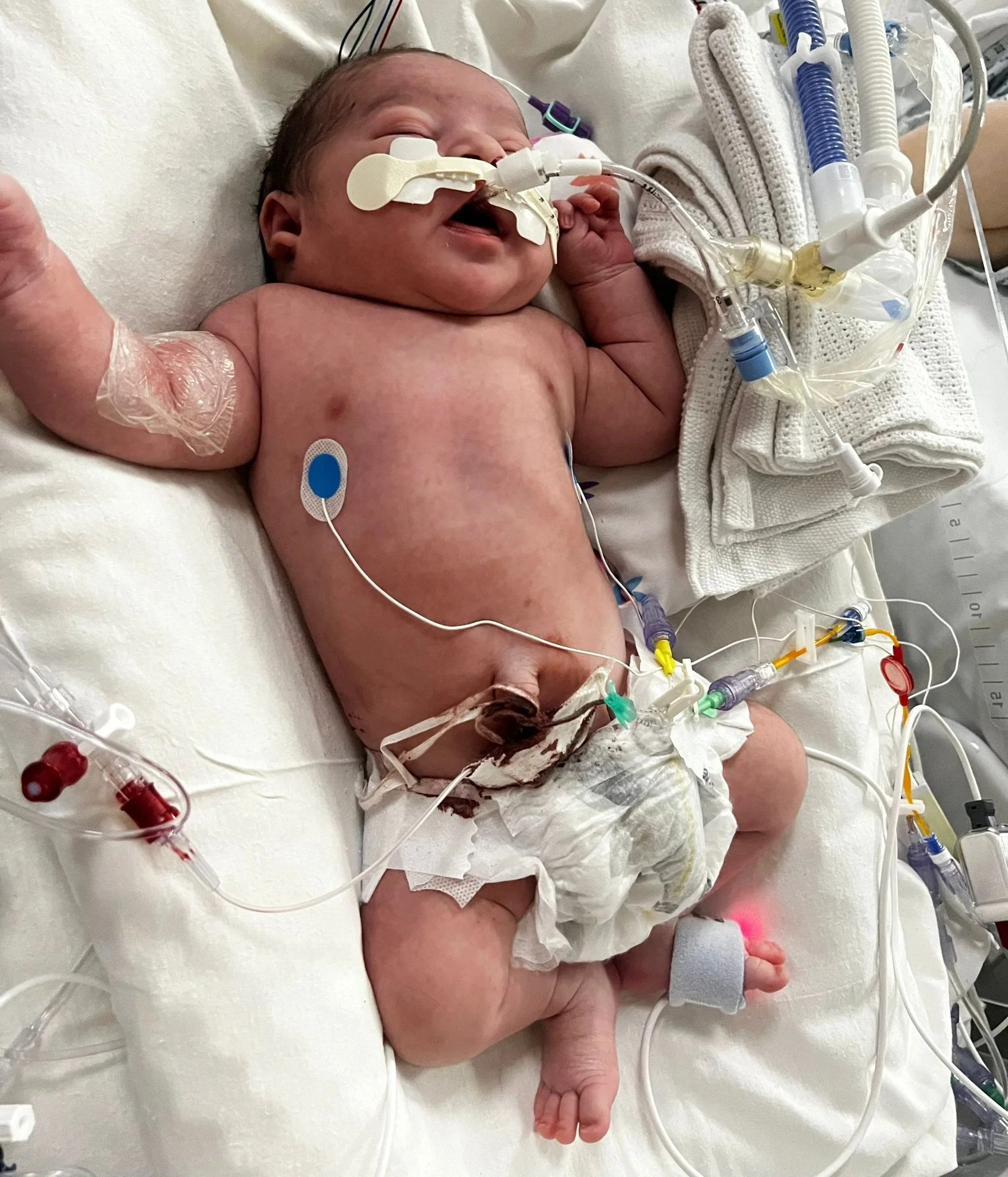 ‘My baby was left with brain damage after he was deprived of oxygen’