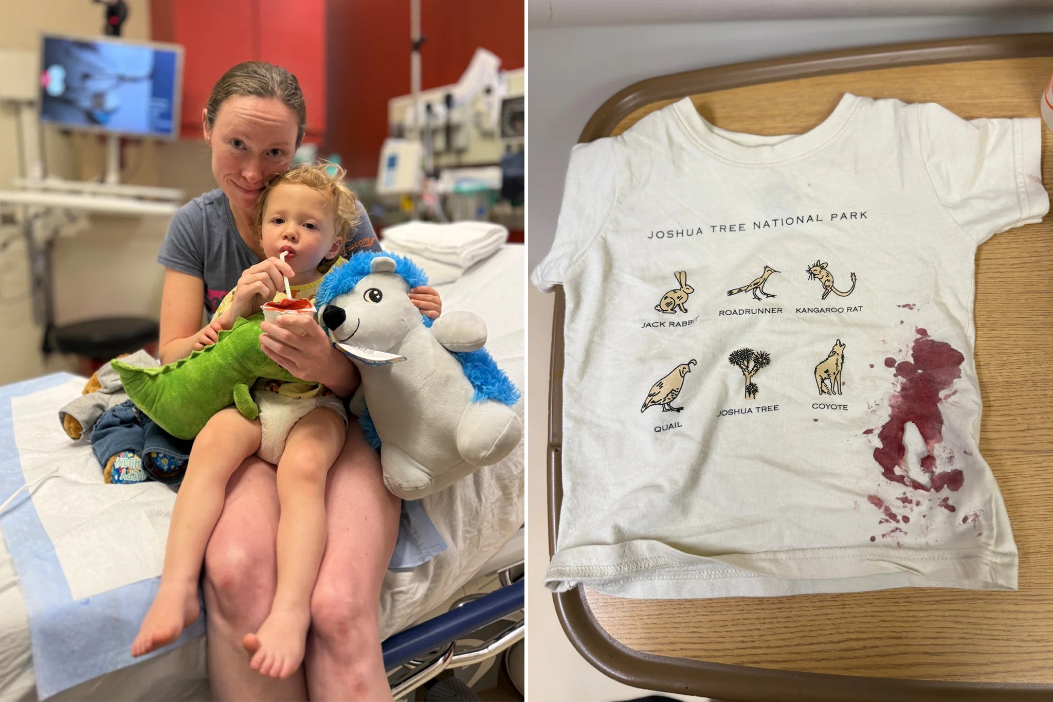 2-year-old left needing stitches and rabies shot after being attacked by a raccoon at Massachusetts playground: ‘It happened so fast’