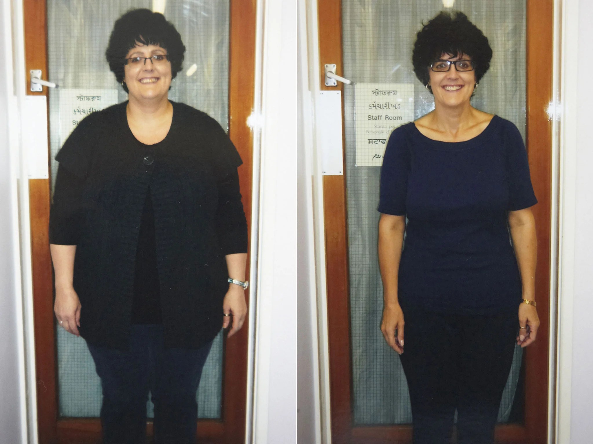 6 Month Diet Before Weight Loss Surgery 6 Month Diet Before Weight Loss Surgery