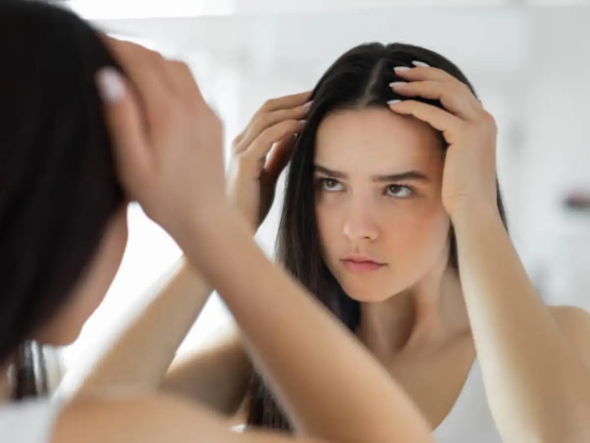 Diet mistakes can cause uncontrolled dandruff on scalp | The Times of India