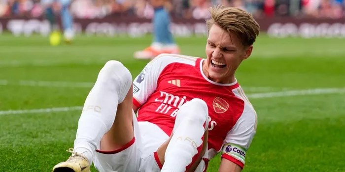 Strategi Cerdas Arsenal Menangani Cedera Martin Ødegaard!