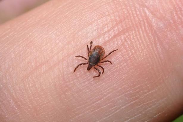 How Can You Avoid Reinfestation After Lice Treatment? Expert Tips for Prevention