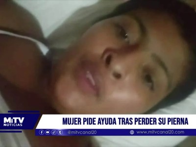 Andry perdió una pierna tras un accidente y hoy lucha por empezar de nuevo