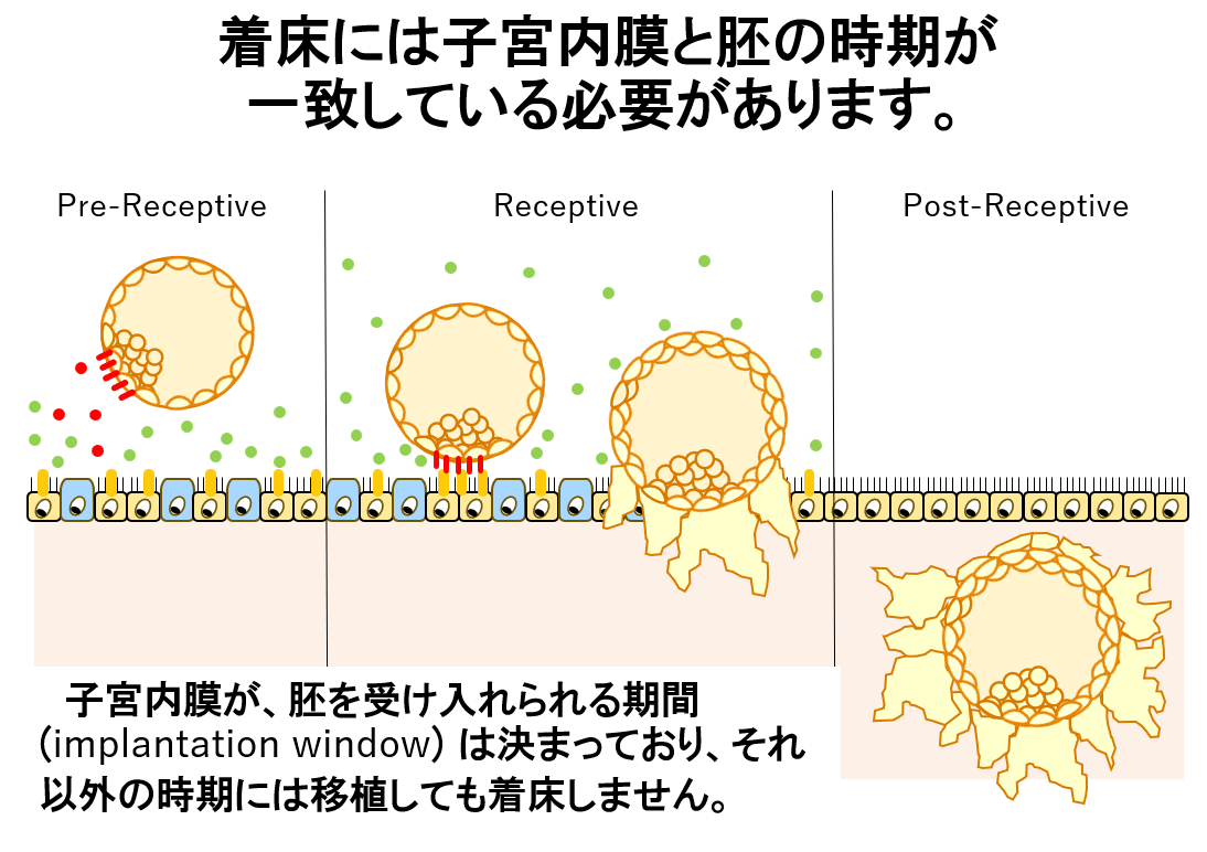 反復着床不成功／着床前遺伝学的検査（PGT-A PGT-SR）について | 梅ヶ丘産婦人科