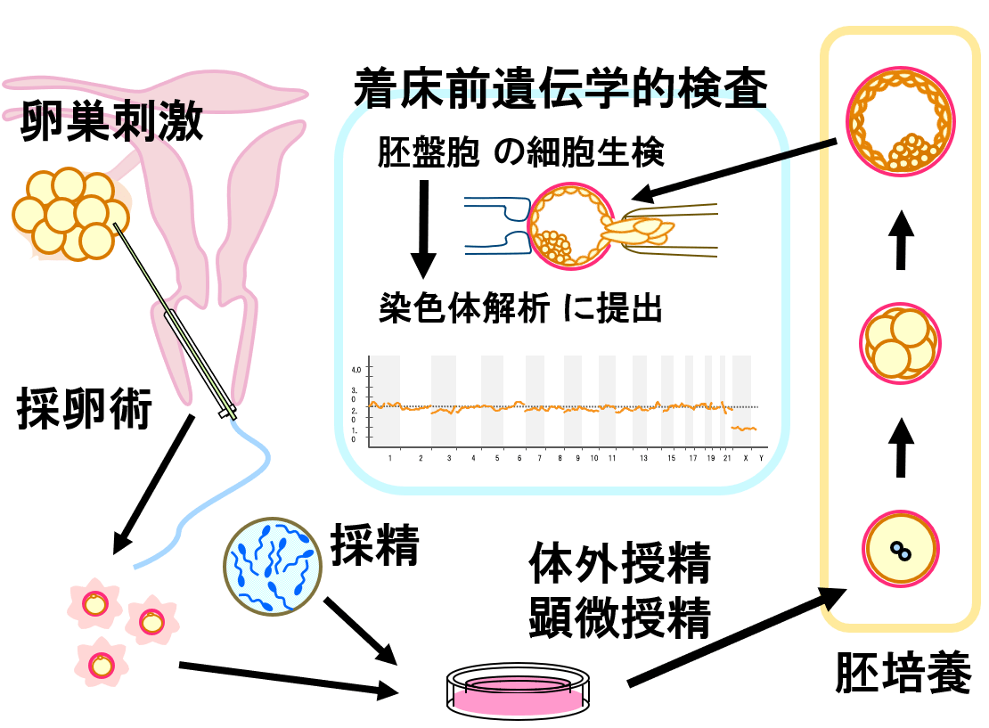 反復着床不成功／着床前遺伝学的検査（PGT-A PGT-SR）について | 梅ヶ丘産婦人科