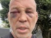 El ex campeón de UFC culpa a Wanderlei Silva por un incidente posterior a la pelea que provocó lesiones