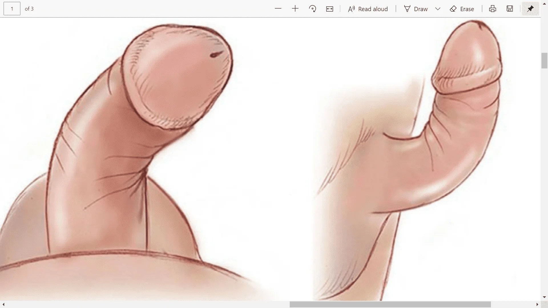 عکس الت تناسلی مردانه