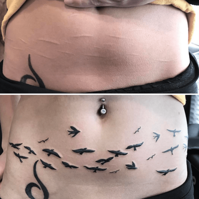 This Artist Tattoos Over Scars To Help People Heal 642_x_640_jpg