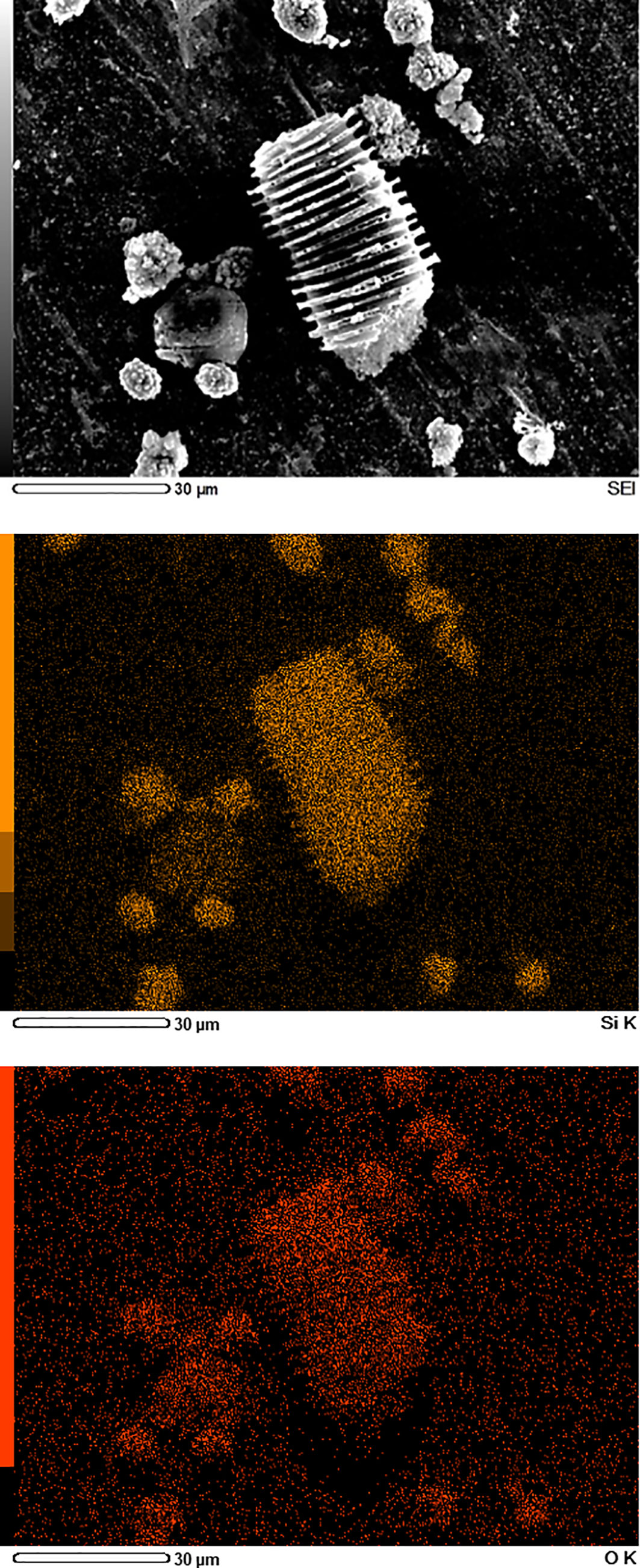 Frontiers Microscopic Investigationsof Silicification And Lignification Suggest Their Coexistence In Tracheary Phytoliths In Date Fruits Phoenix Dactylifera L Plant Science