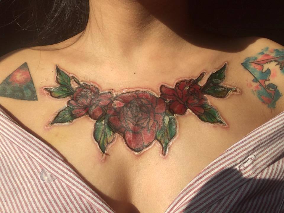 Thailandia, Il Tatuaggio Sul Petto Cade Ma Resta Una Cicatrice Orrenda 720_x_960_jpg