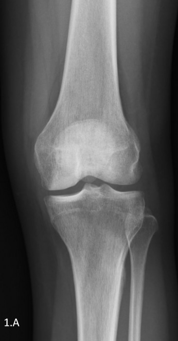 Centre d&rsquo;imagerie Ostéo-Articulaire | Clinique du sport de Bordeaux