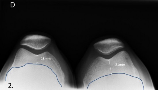 Centre d&rsquo;imagerie Ostéo-Articulaire | Clinique du sport de Bordeaux