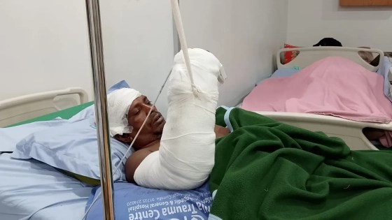 সাড়ে ৩ ঘণ্টায় জোড়া লাগানো হলো পলিথিনে আনা বিচ্ছিন্ন হাত