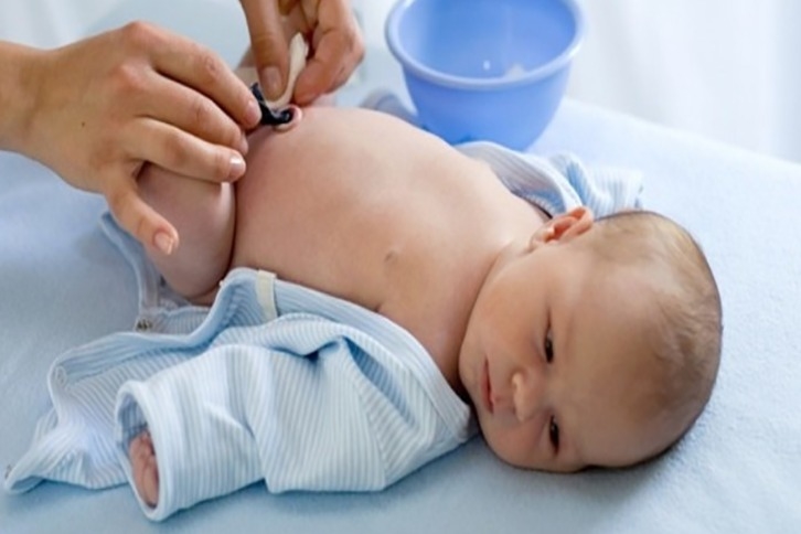 Cara Merawat Tali Pusar Bayi yang Baik dan Benar hingga Puput – RSU Budi  Rahayu