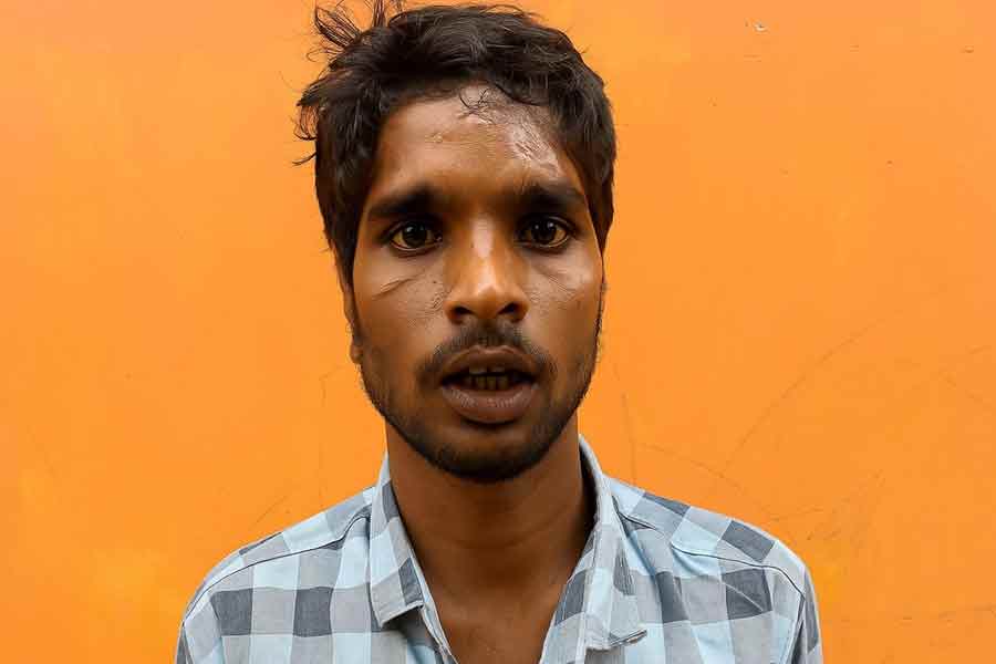 পাওনা টাকা চাওয়ার ‘শাস্তি’, মুম্বইতে নলহাটির যুবকের কান কাটল ঠিকাদারের সাগরেদরা!