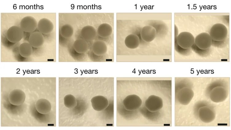 Los científicos construyeron cerebros en miniatura que pueden experimentar el paso del tiempo