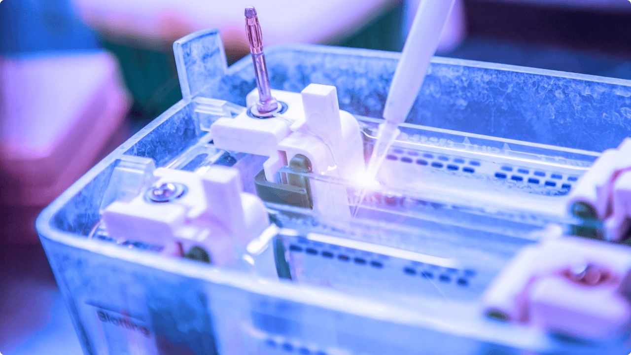 Eletroforese de hemoglobina codigo tuss