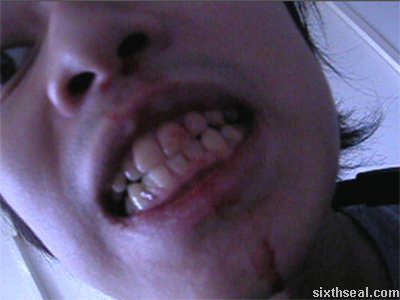 Download My Nosebleed Video While It's Still Fresh! ;) – Sixthseal.com 300_x_400_jpg