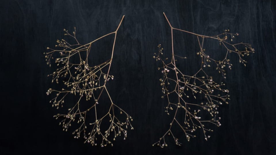 Medizinethik Pro Und Contra Organspende Was Sagt Das Christentum Kultur Srf