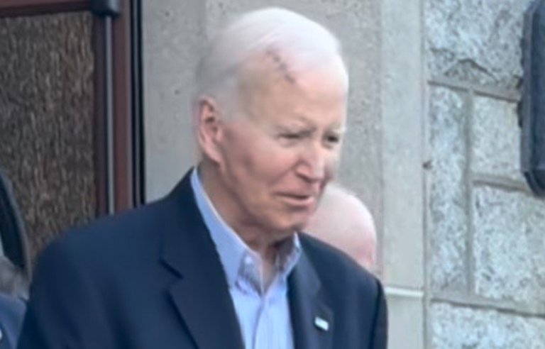 BREAKING: Biden Seen with Massive Gash on His Head (VIDEO) | The Gateway Pundit