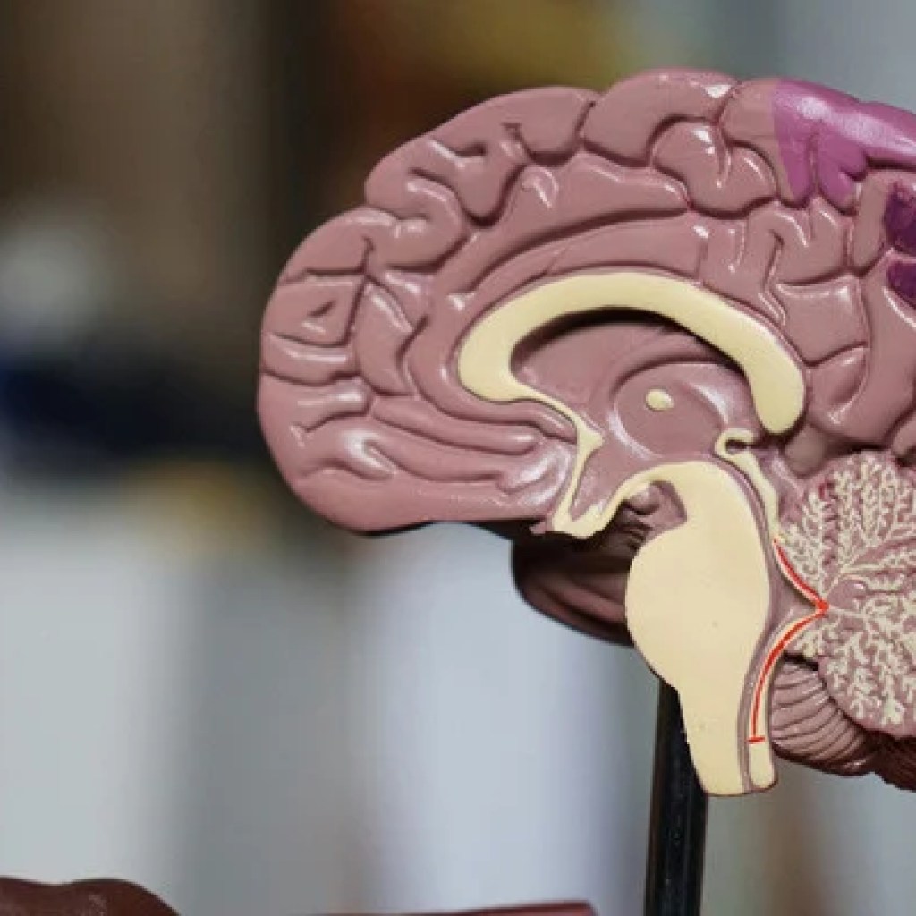 Your brain’s health is declining — here’s what you can do about it