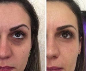 Wake Up To Makeup Naples | Permanent Makeup, Tattoo Removal & More 248_x_300_jpg