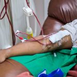 El costo de la diálisis y otros tratamientos a cargo de BPJS Health