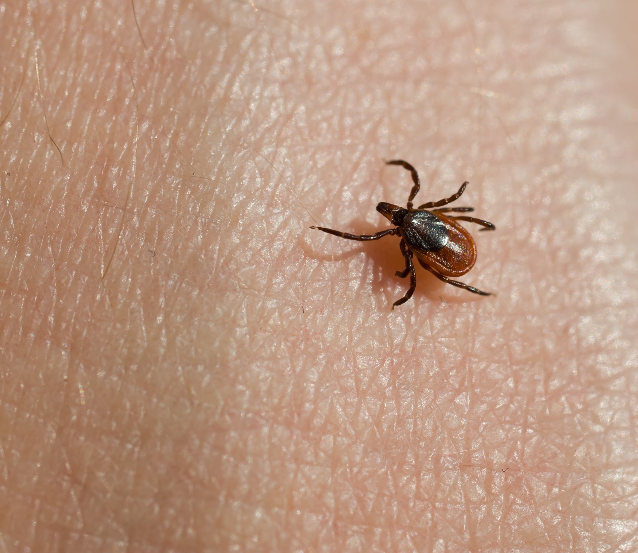 Collection 32+ Background Images picture of ticks that carry lyme disease Sharp